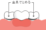 ireba.gif